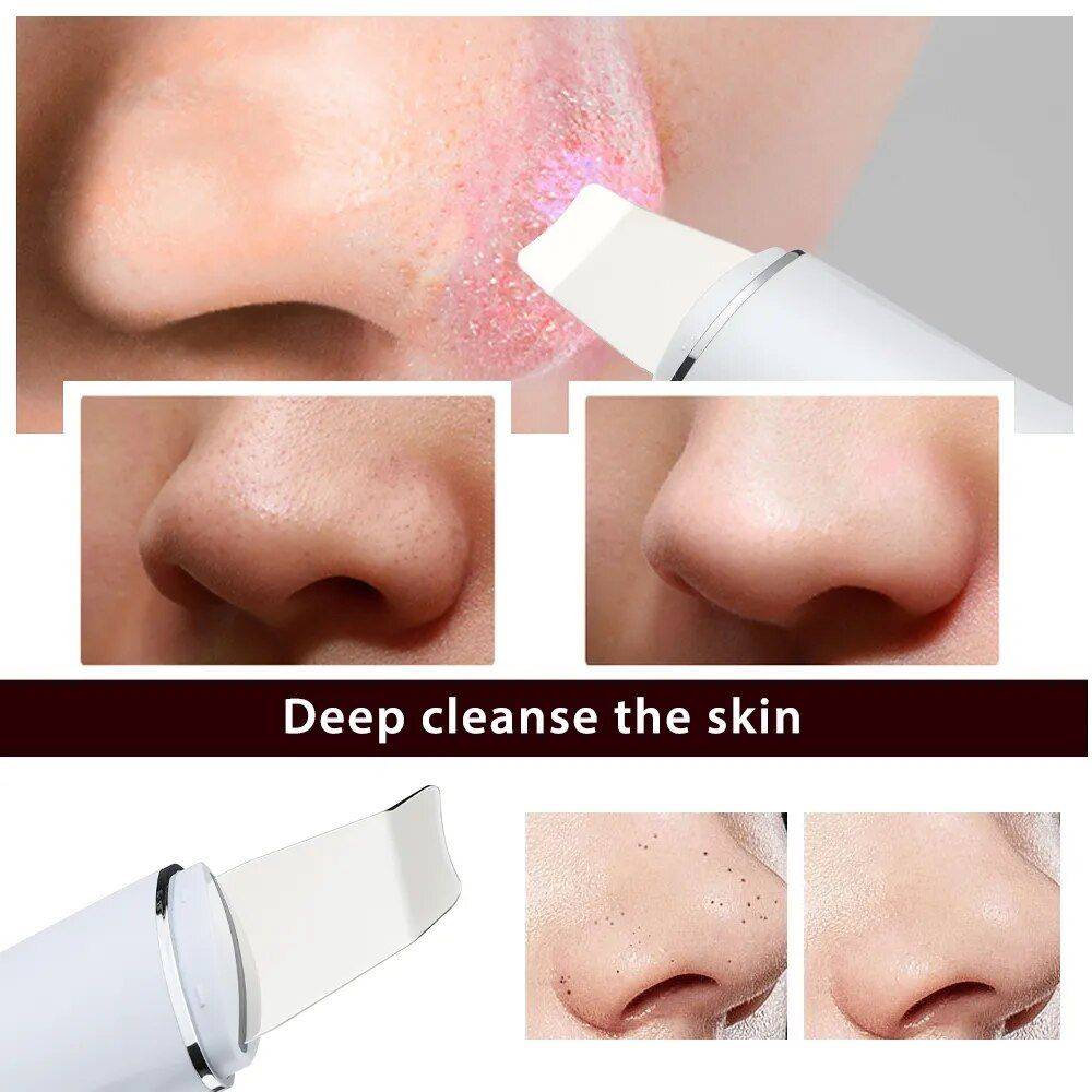 Ultrasonic Skin Scrubber Health & Beauty